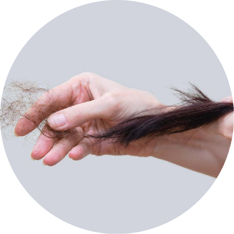 A woman experiencing excessive hair shedding, one of the key hair loss problems that QR678® Neo effectively treats in Canada.