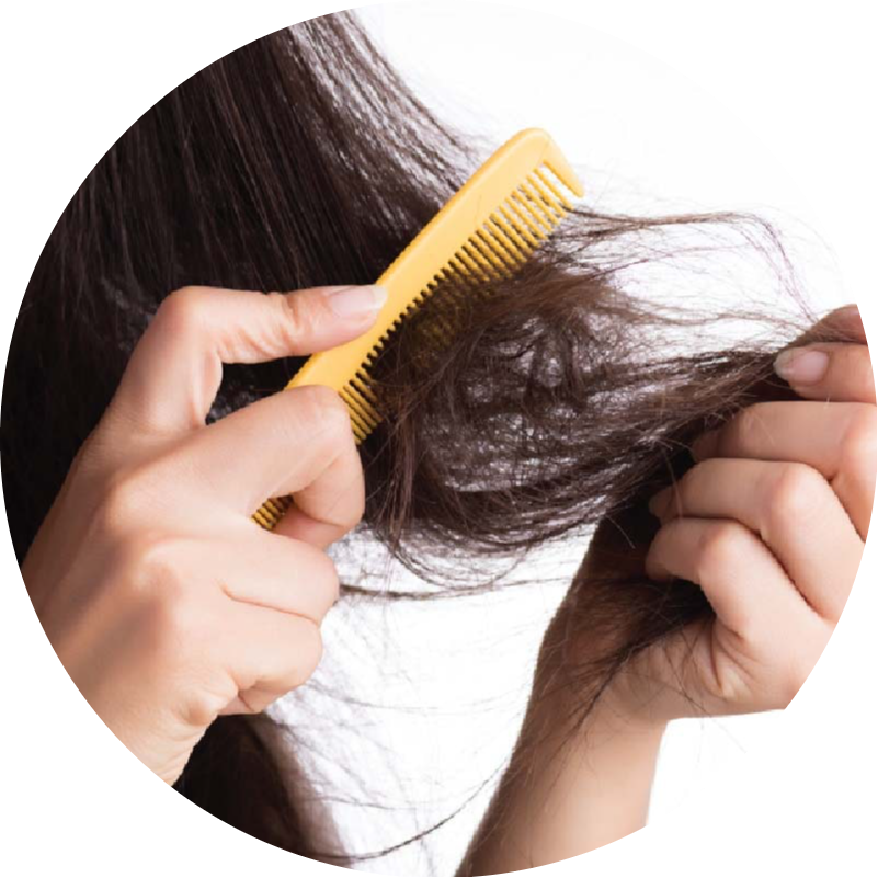 A woman experiencing hair fall, which significantly decreased after 5 sessions of QR678® Neo treatment in Canada.